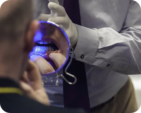 image closeup of dental work