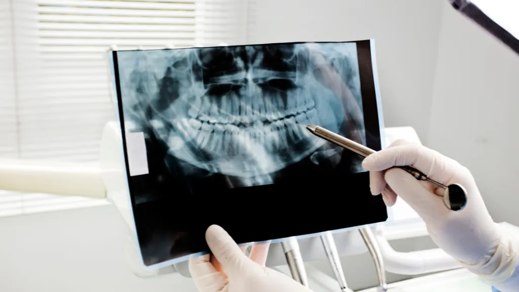 https://decare.ie/wp-content/uploads/2025/08/Dental-X-Rays.webp
