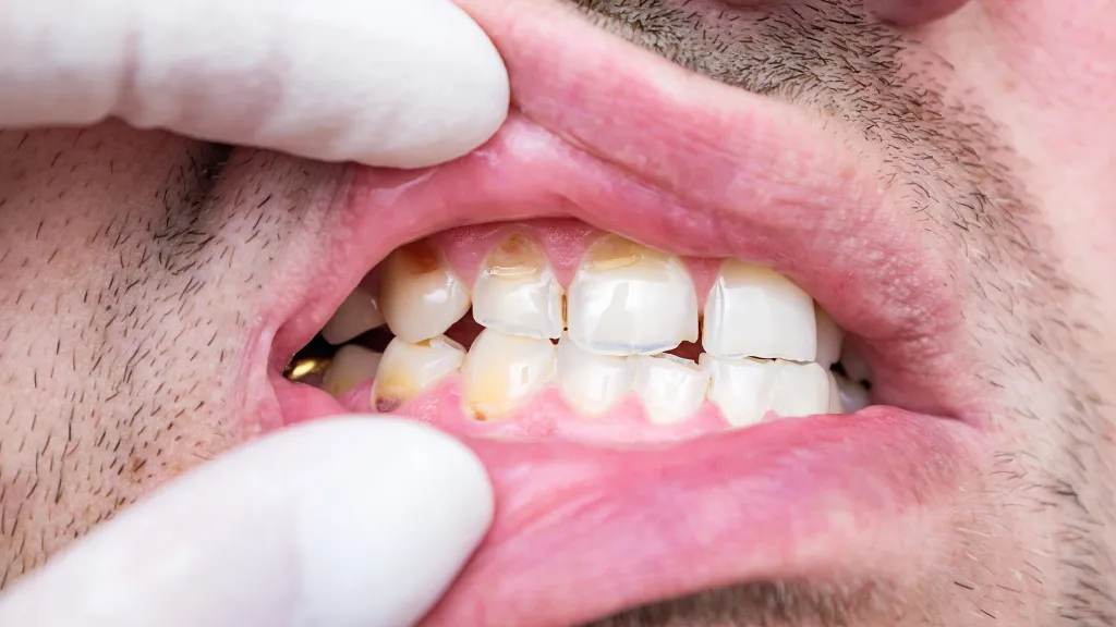 https://decare.ie/wp-content/uploads/2025/08/Hypoplasia.webp