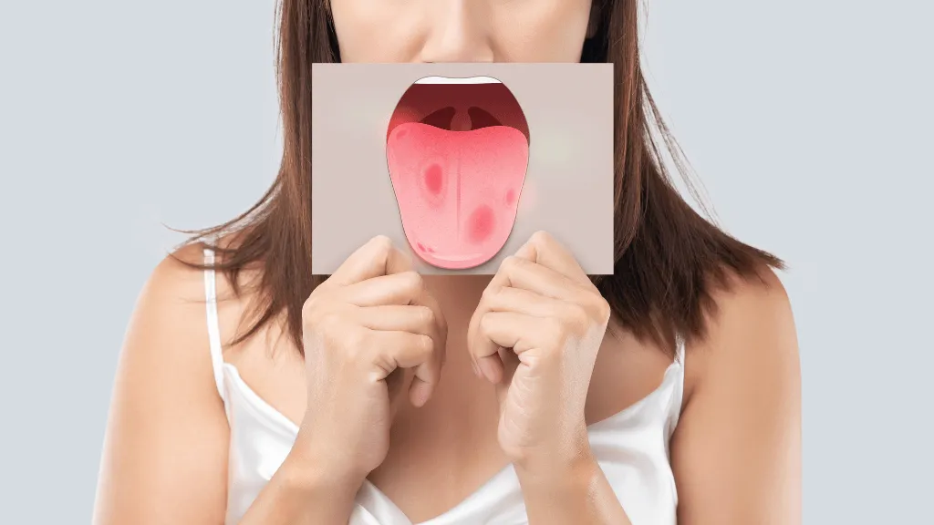 Sharp tooth tongue trauma