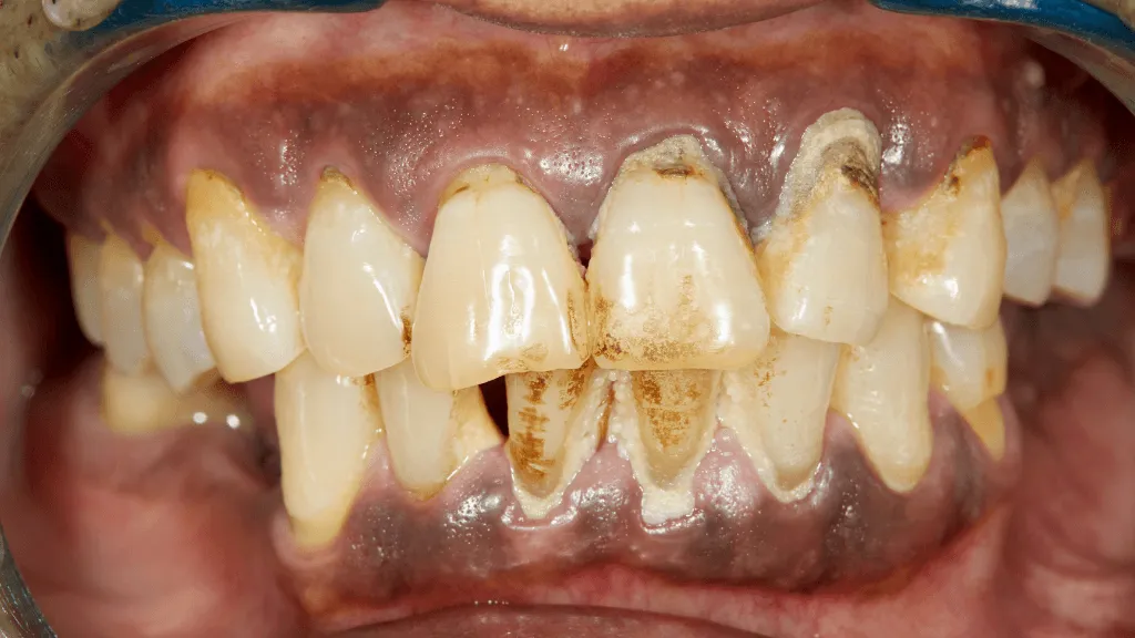 https://decare.ie/wp-content/uploads/2026/07/New-Blog-Dimensions-2-1-640x300-c-default.webp
