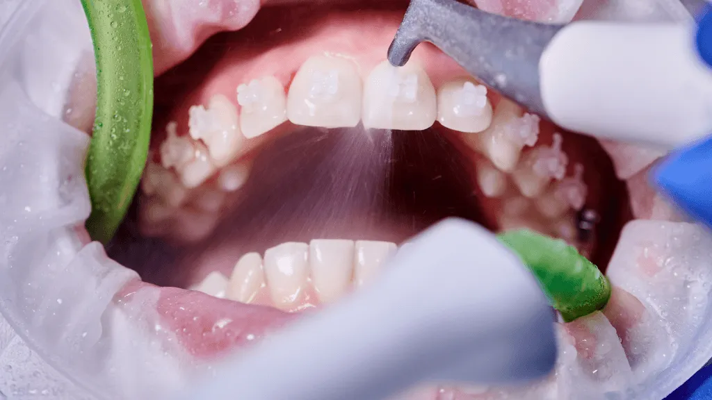 Why are dental cleanings so important?